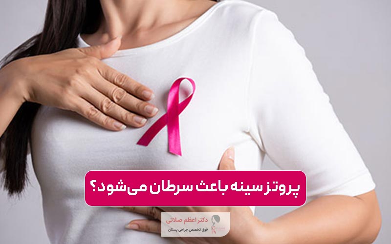 آیا پروتز سینه باعث سرطان میشود؟ ارتباط پروتز پستان با ALCL