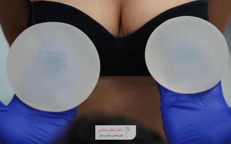 ارتباط بین بلوغ جسمی و عاطفی زنان با جراحی پروتز سینه و کاشت ایمپلنت پستان