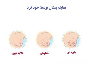 معاینه-پستان-توسط-خود-فرد