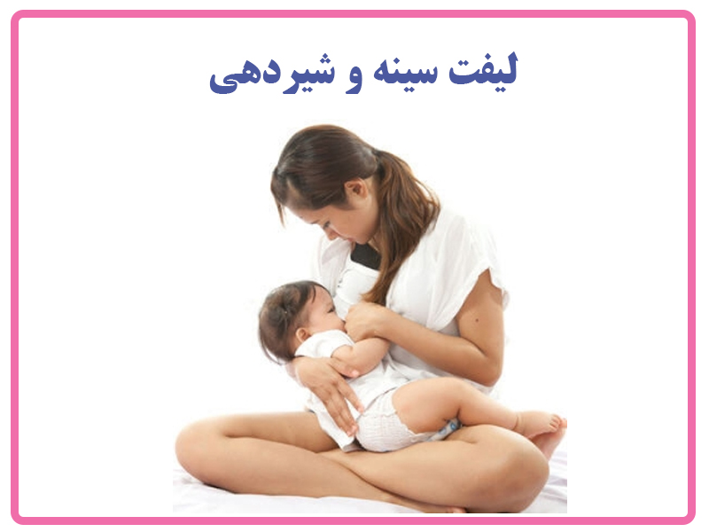 لیفت سینه و شیردهی
