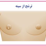 ترشح از سینه