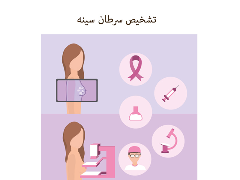 تشخیص سرطان سینه