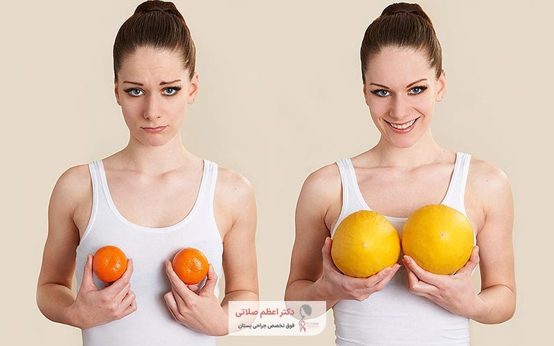 قیمت و هزینه جراحی پروتز سینه توسط پزشک و دکتر خانم چقدر است