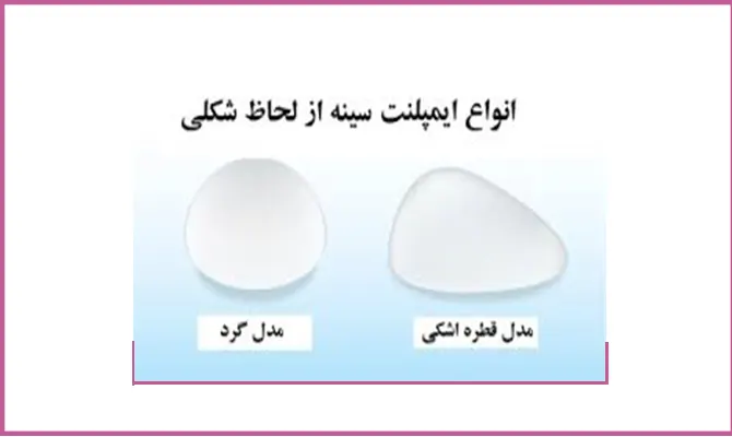 ایمپلنت پستان نوع اشکی