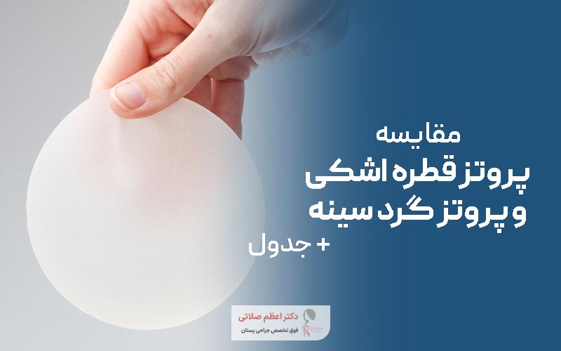 مقایسه پروتز اشکی سینه با ایمپلنت گرد پستان در زنان