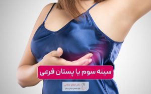 سینه سوم یا پستان فرعی چیست؟ علت پدیدار شدن آن در زنان