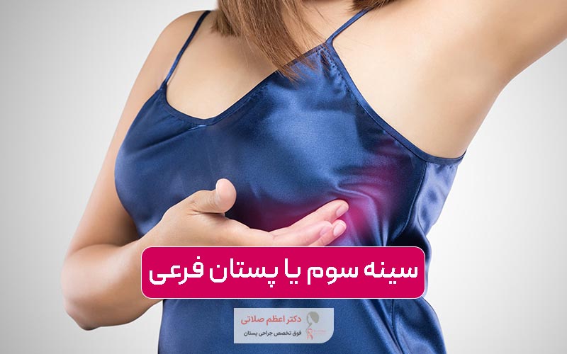 سینه سوم یا پستان فرعی چیست؟ علت پدیدار شدن آن در زنان