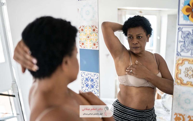 سینه سوم یا پستان فرعی چیست و چرا درمان آن اهمیت دارد