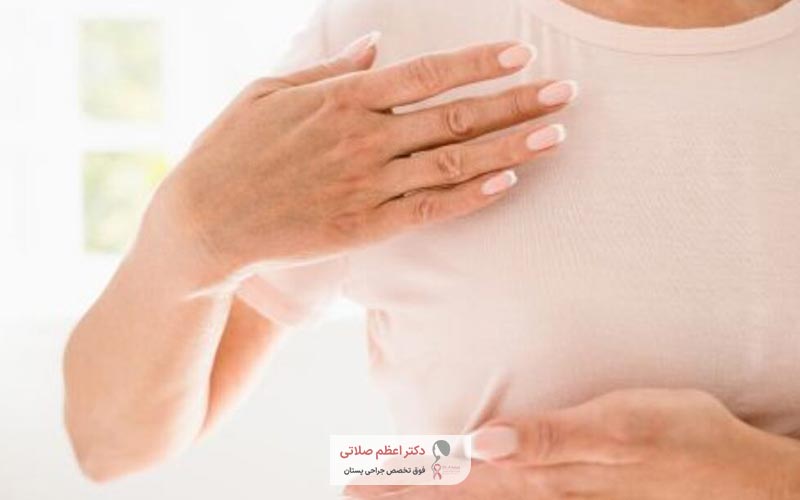 علائم و نشانه های پستان فرعی و سینه سوم در زنان