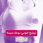 ترشح خونی نوک سینه زنان نشانه چیست و چه علتی دارد؟