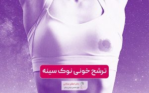 ترشح خونی نوک سینه زنان نشانه چیست و چه علتی دارد؟