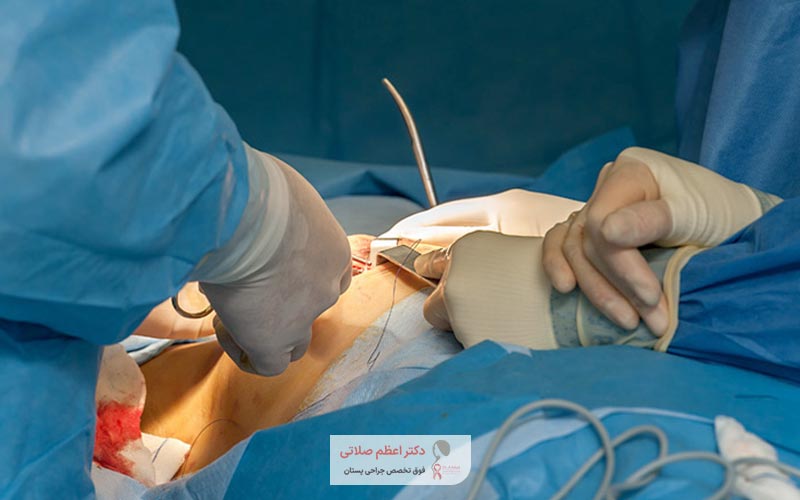 ویژگی های بهترین جراح سرطان سینه در تهران چیست