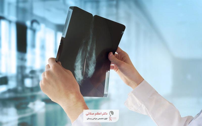 اقدامات ضرروی قبل از انجام جراحی سرطان سینه