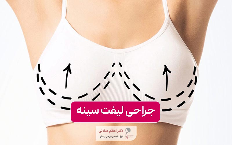 جراحی لیفت سینه چیست؟ نحوه عمل لیفت پستان یا بالا کشیدن آن