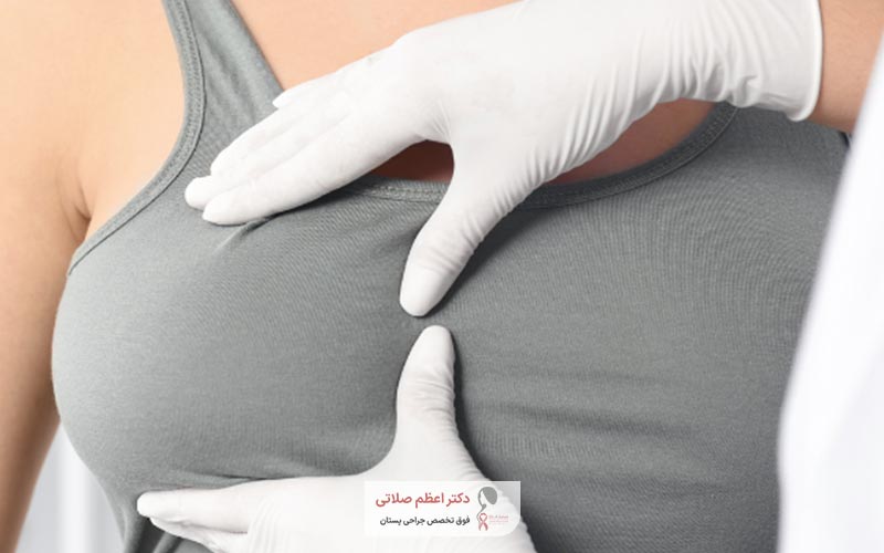 علت و دلایل انجام عمل لیفت پستان و سینه در زنان