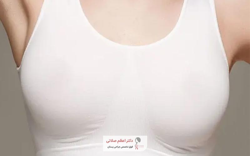 لیفت سینه و پستان در زنان چیست و به چه معناست