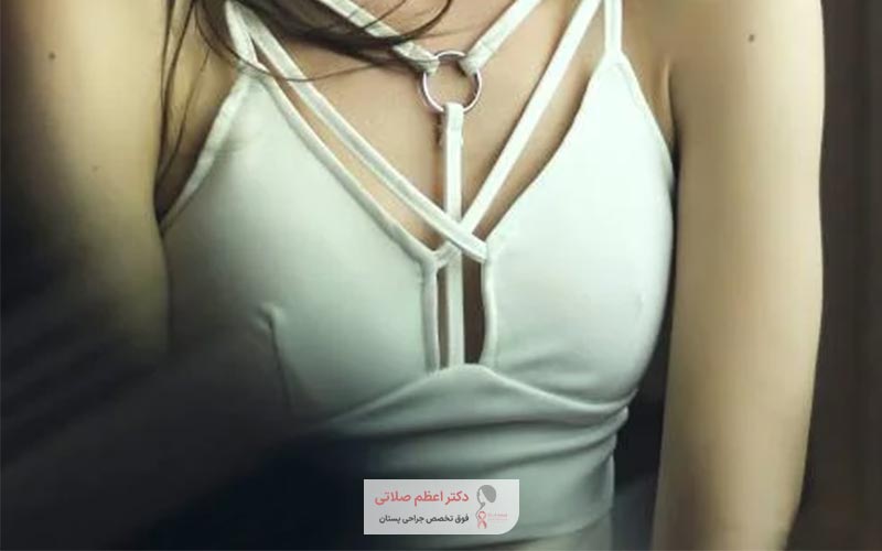 عمل لیفت سینه چیست و چه کاربردی برای زنان دارد