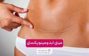 مینی ابدومینوپلاستی چیست و چگونه انجام میشود؟ تفاوت آن با ابدومینوپلاستی کامل