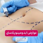 عوارض ابدومینوپلاستی و جراحی زیبایی شکم در زنان و مردان