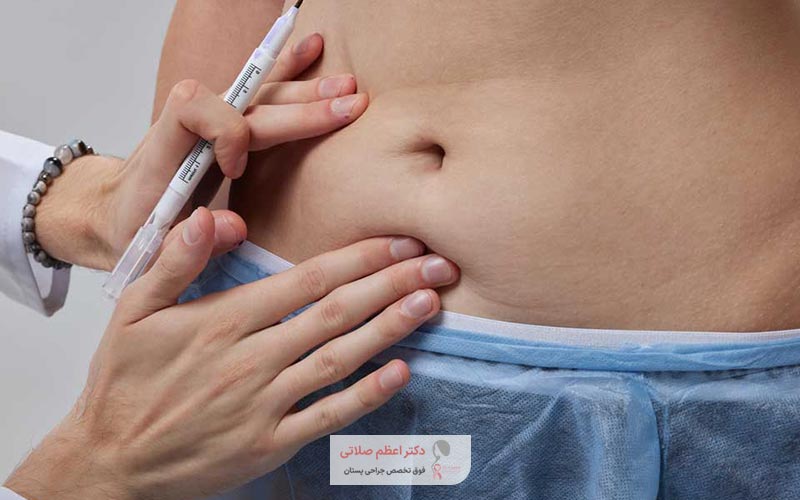 عوارض ابدومینوپلاستی و عمل جراحی زیبایی شکم چیست