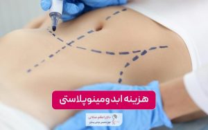هزینه ابدومینوپلاستی در سال ۱۴۰۴ در شهر تهران؛ عوامل موثر بر قیمت جراحی زیبایی شکم