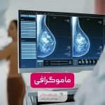 ماموگرافی چیست و چگونه انجام می‌شود؟ بهترین زمان ماموگرافی برای زنان کی است
