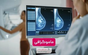 ماموگرافی چیست و چگونه انجام می‌شود؟ بهترین زمان ماموگرافی برای زنان کی است