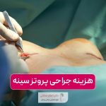 هزینه پروتز سینه در سال 1404 و بررسی عوامل موثر بر قیمت جراحی پروتز پستان در تهران