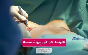 هزینه پروتز سینه در سال 1404 و بررسی عوامل موثر بر قیمت جراحی پروتز پستان در تهران