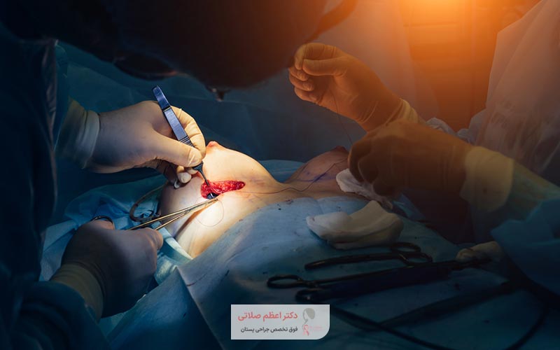هزینه جراحی پروتز سینه و پستان در زنان در شهر تهران در سال ۱۴۰۴