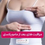 مراقبت های بعد از ماموپلاستی و نکات مهم آن