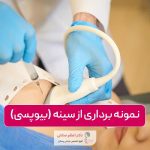 نمونه برداری از سینه یا بیوپسی چیست؟ دلایل و کاربرد بیوپسی سینه زنان