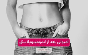 آمبولی بعد از ابدومینوپلاستی و جراحی زیبایی شکم به همراه علائم و علت های آن