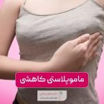ماموپلاستی کاهشی یا جراحی کوچک کردن سینه و پستان در زنان چیست و چه مزایا و عوارضی دارد؟