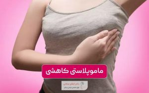 ماموپلاستی کاهشی یا جراحی کوچک کردن سینه و پستان در زنان چیست و چه مزایا و عوارضی دارد؟