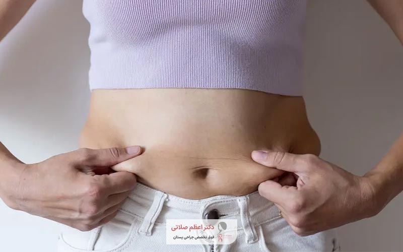 بهترین جراح ابدومینوپلاستی تهران در منطقه سعادت آباد و بلوار کشاورز کیست