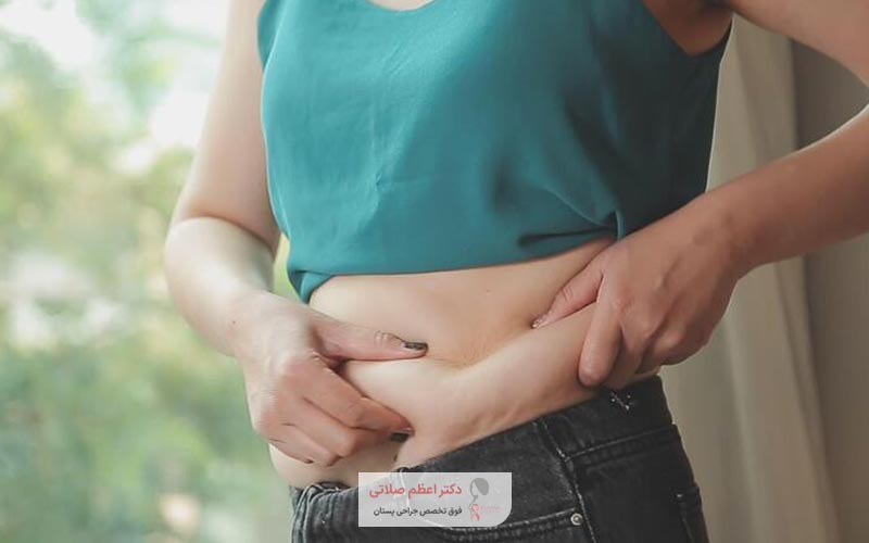 رضایت بیماران و زیباجویان قبلی از عملکرد جراح ابدو و زیبایی شکم