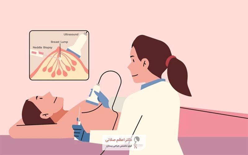 علت انجام بیوپسی سینه در زنان چیست