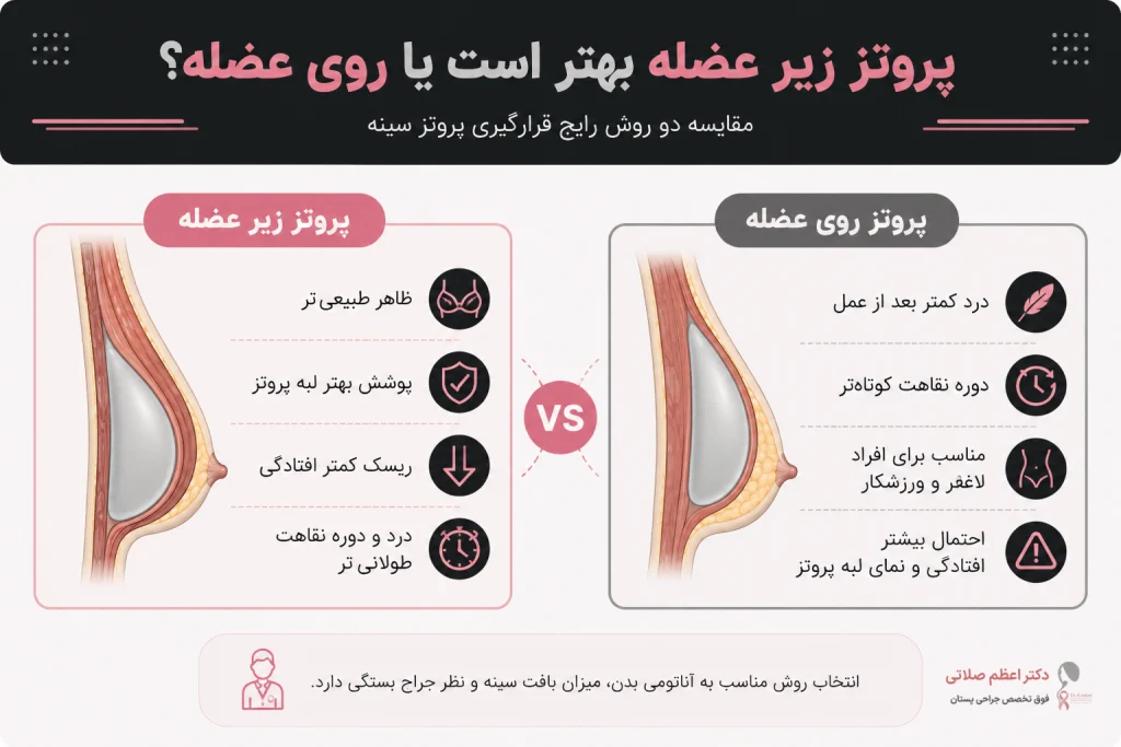 پروتز زیرعضله یا روی عضله