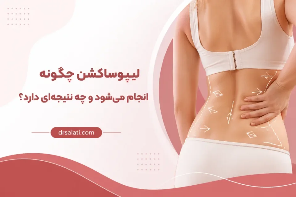 نمای توضیحی درباره پشت و کمر