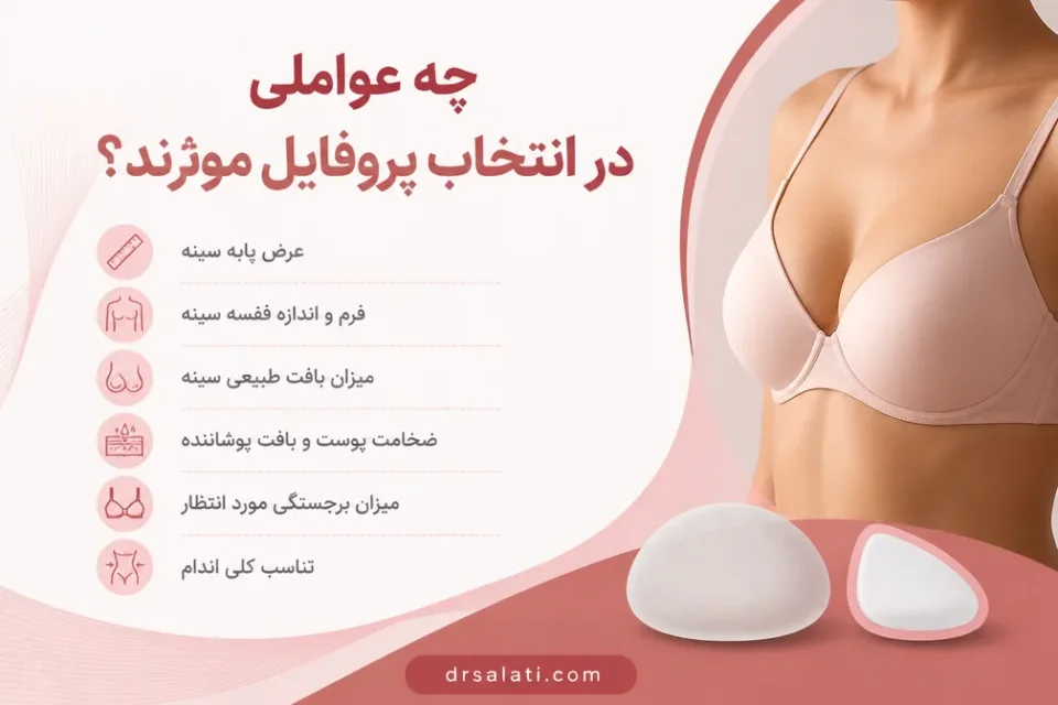 نمای توضیحی درباره چه عواملی در انتخاب پروفایل مؤثرند