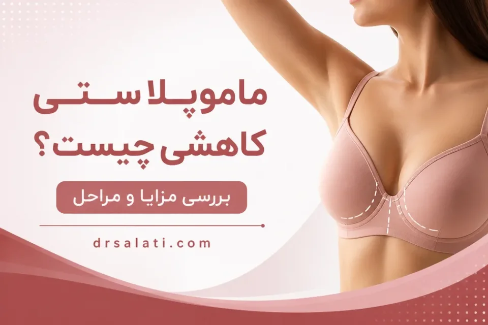 نمای توضیحی درباره ایجاد برش