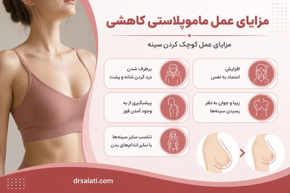 نمای توضیحی درباره مزایای عمل ماموپلاستی کاهشی