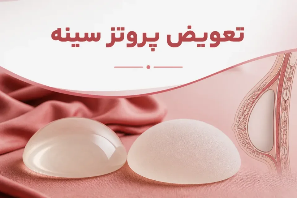 نمای توضیحی درباره قرار دادن پروتز جدید و اقدامات تکمیلی