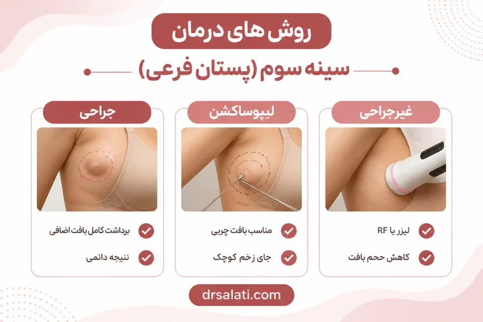 درمان سینه سوم یا پستان فرعی